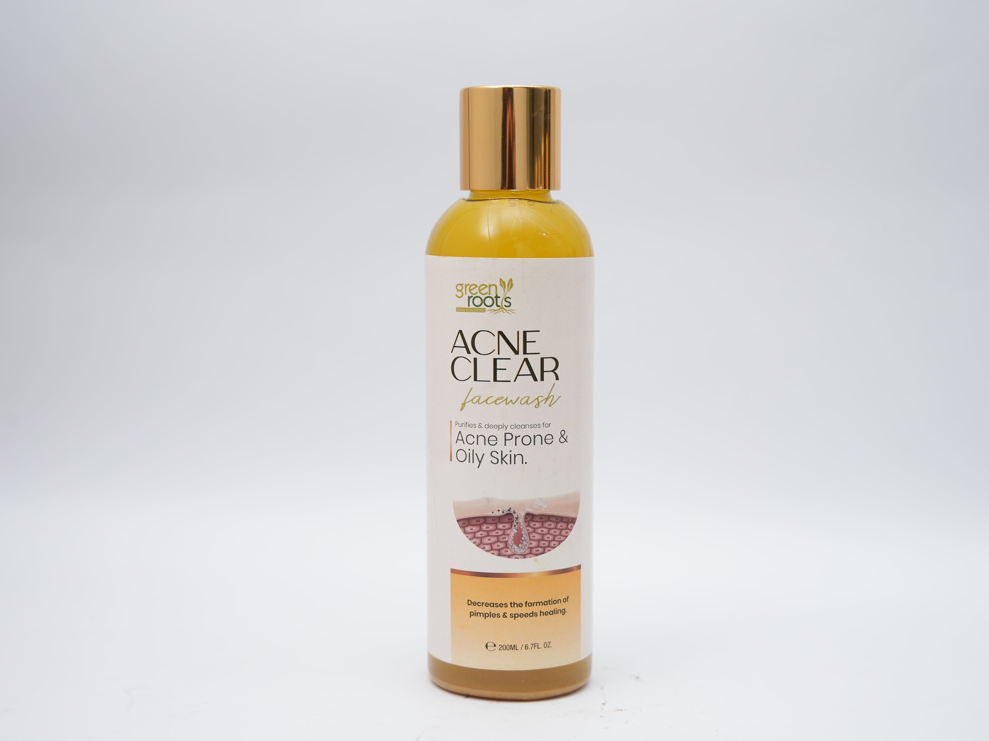 Organic Acne Clear Face Wash in Pakistan by Green Roots, shown in a golden bottle designed for acne-prone and oily skin, promoting clear and healthy complexion.