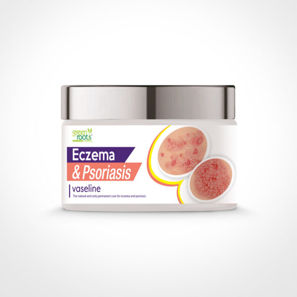 Eczema and Psoriasis Vaseline