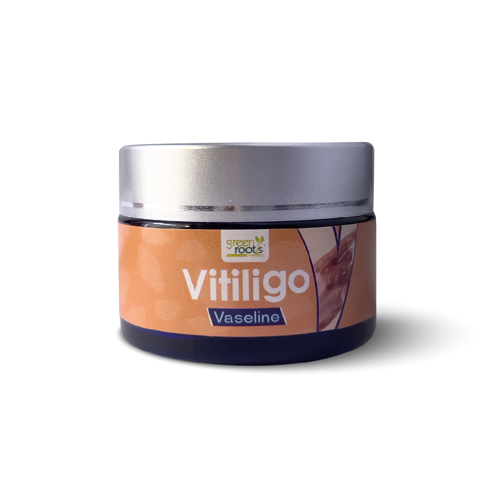 Vitiligo Vaseline